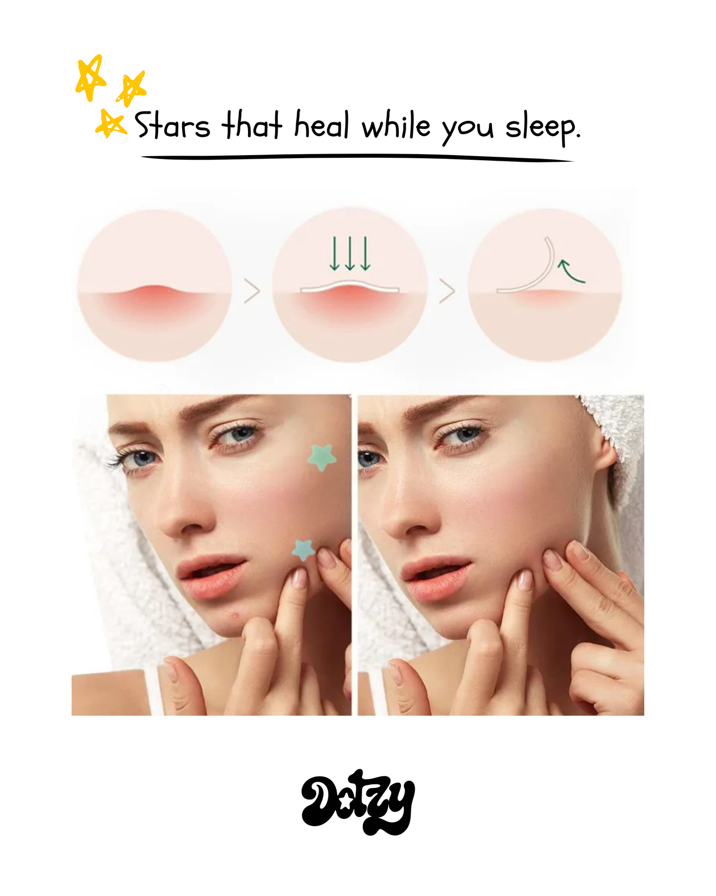 Dotzy StarPatch™